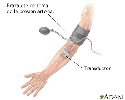 Examen de ultrasonido Dúplex/doppler