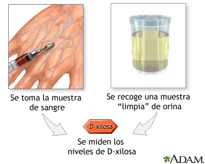 Exmenes de niveles D-xylosa