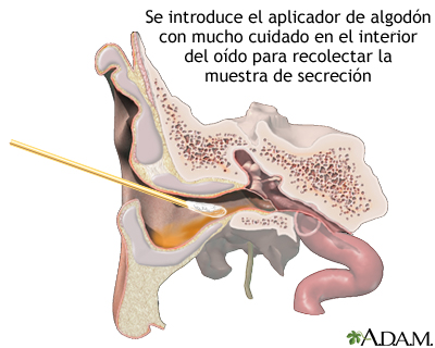 Cultivo del drenaje del oído