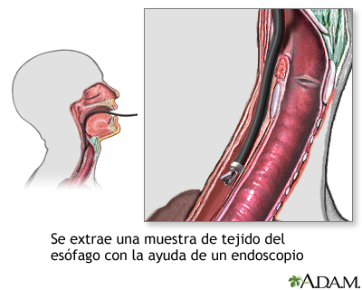 Cultivo de tejido esofágico