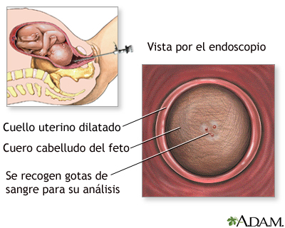 Examen sanguíneo fetal