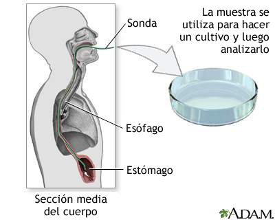 Cultivo de tejido gástrico