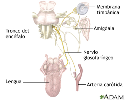 Neuralgia glosofaríngea