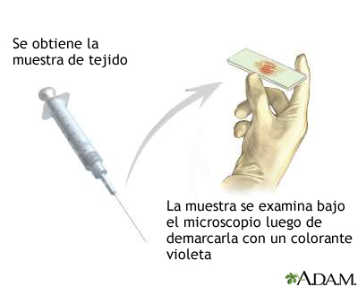 Tinción de gram de biopsia tisular