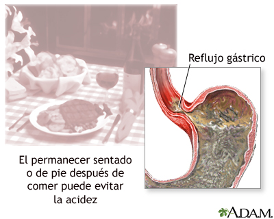 Prevención de la acedía