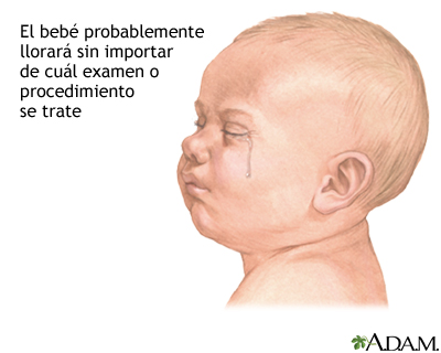 Preparación para un examen o procedimiento en un niño menor de un año