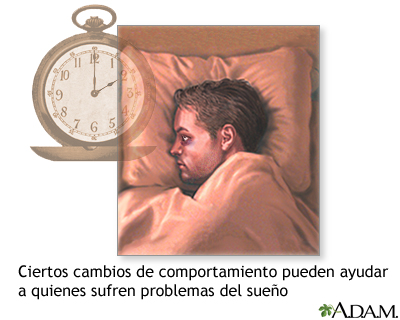 Problemas de insomnio