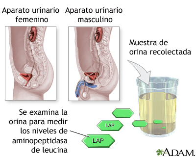 Prueba de aminopeptidasa de leucina en orina