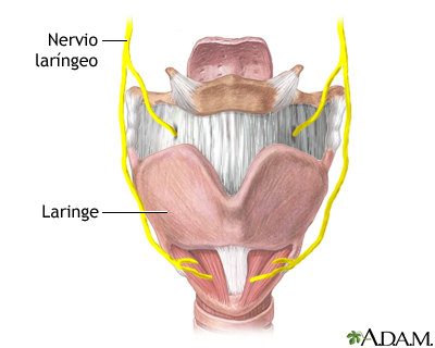 Daño al nervio laríngeo