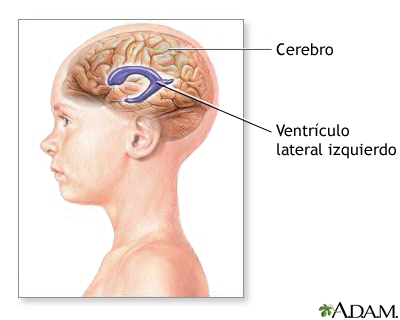 Ventrculos del cerebro