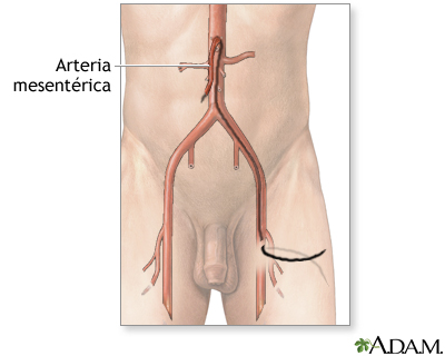 Arteriografía mesentérica