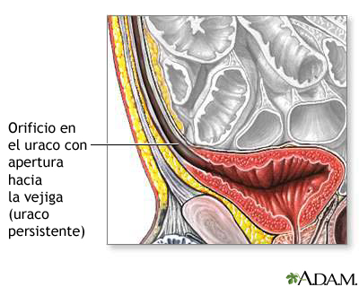 Uraco permeable