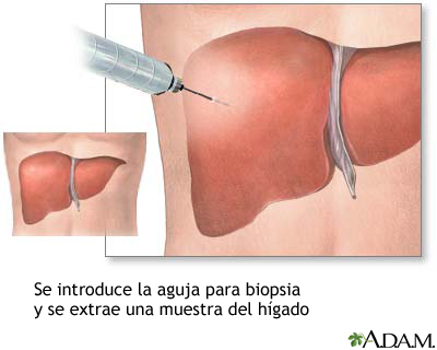 Cultivo de tejido hepático