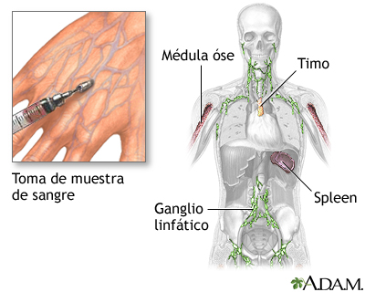 Examen de azul de nitro-tetrazolio