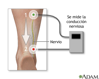 Prueba de conducción nerviosa