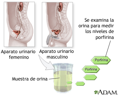 Prueba de porfirina en la orina