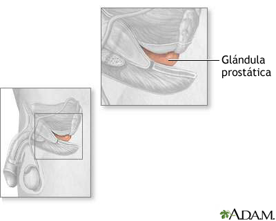 Glándula prostática