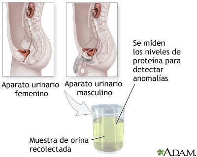 Prueba de proteína en la orina