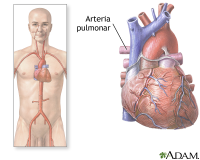 Arterias pulmonares