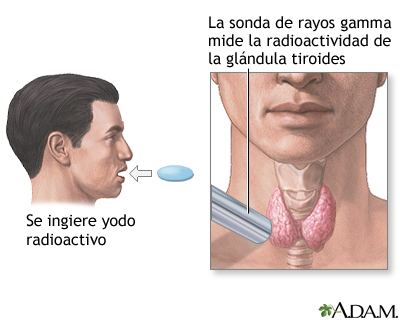 Prueba de radioactividad