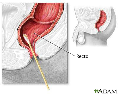 Cultivo rectal