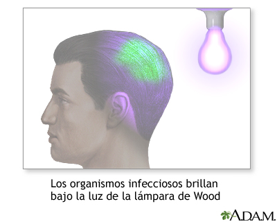 Iluminación de lámpara de Wood