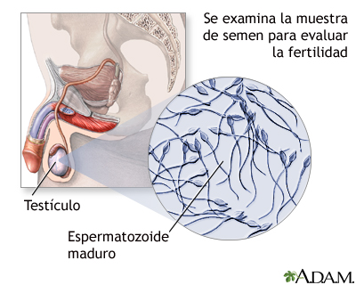 Análisis del semen