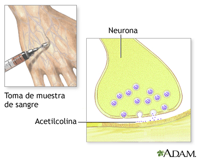 Examen de colinesterasa