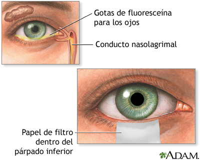 Examen de Shirmers