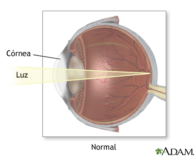 Visión normal