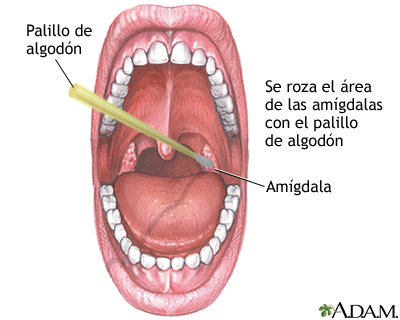 Cultivos de garganta