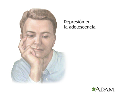 Depresión en el adolescente