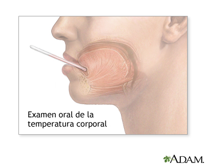 Medición de la temperatura