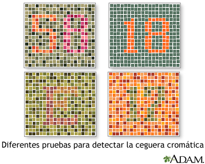 Pruebas para el daltonismo