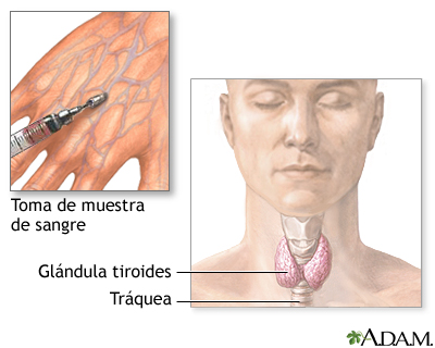 Examen de función tiroidea