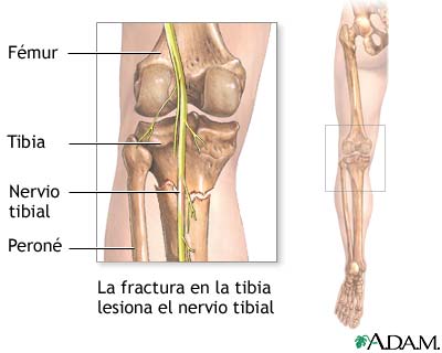 Nervio tibial