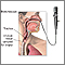 Upper airway test