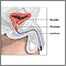 Prostatectomy  - series