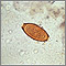 Trichuris trichiura egg