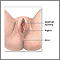 Anterior vaginal wall repair (Surgical treatment of urinary incontinence) - series