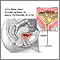 Bladder catheterization, female