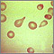 Red blood cells, tear-drop shape