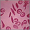 Red blood cells, multiple sickle cells