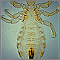 Body louse