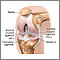 Knee arthroscopy - series