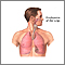 Lung transplant - series