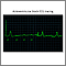 Registro del ECG durante un bloqueo auriculoventricular