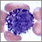 Basophil (close-up)