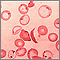 Red blood cells, sickle and pappenheimer