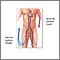 Venous thrombosis - series